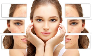 Glycolic Acid—the Real Skincare Hero