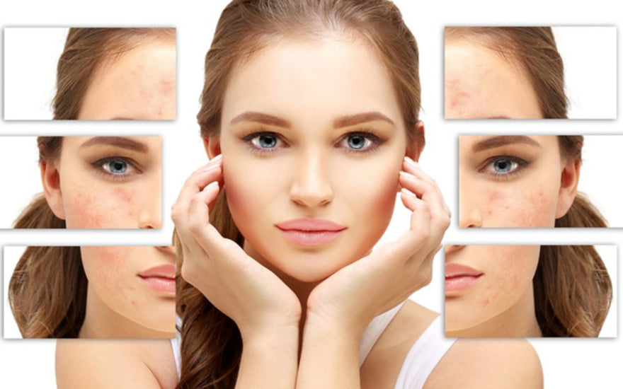 Glycolic Acid—the Real Skincare Hero